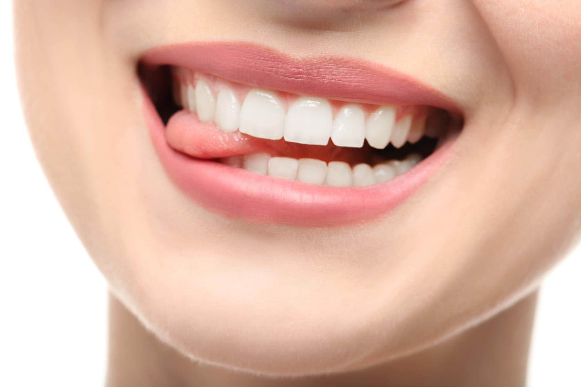 Diseño de sonrisa